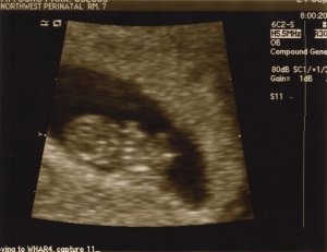 ultrasound 2014-09-24 improved 3.jpg